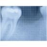 Dental Xray Measuring Grid