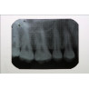 Dental Xray Measuring Grid