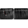 Dental Xray Measuring Grid