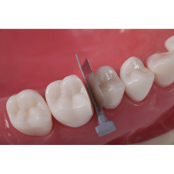 Directa FenderWedge Prep Dental Wedge & Per piece