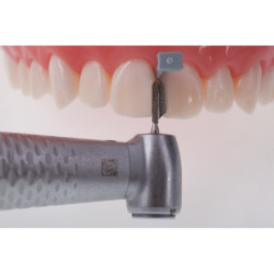 Directa FenderWedge Prep Dental Wedge & Per piece