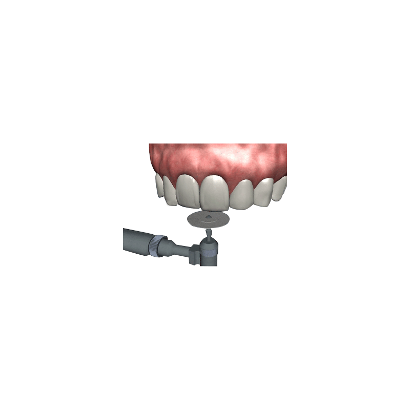 The Tooth- Patient Consultation / Education software - Digital