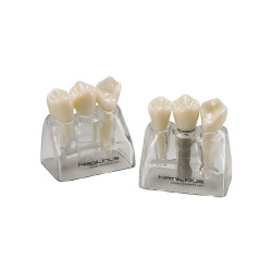 Implant Tooth Model 3000