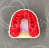 IDRR Orthodontic Training Jaw Model
