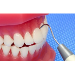 Dental Display / Consultation Model
