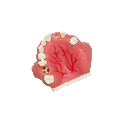 Model for implant placement with sinus septa