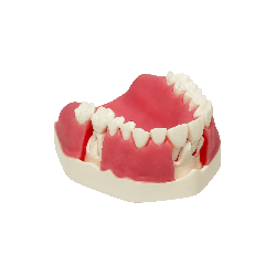 Model with double layered gingiva, sinus lift with Schneiderian membrane and buccal defect in first molar