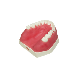 Model with double layered gingiva, sinus lift with Schneiderian membrane and buccal defect in first molar