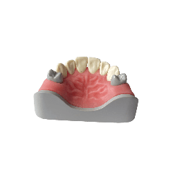 Anterior dentition model for restorations and Core Restorations (Upper)
