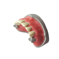 Anterior dentition model for restorations and Core Restorations (Upper)