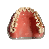Prepared Teeth for Buildups and Post-and-Core Restorations (Upper) Prosthetic Dental Model