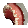 Prepared Teeth for Buildups and Post-and-Core Restorations (Upper) Prosthetic Dental Model