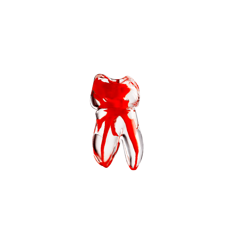 Endo teeth with a colored root canal (Teeth no. 1.6/16/3)