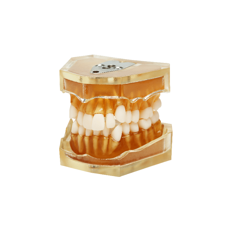 Dental model for teeth extraction