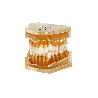 Dental model for teeth extraction