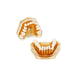 Dental model for teeth extraction
