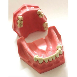 Partial Model for Prosthesis