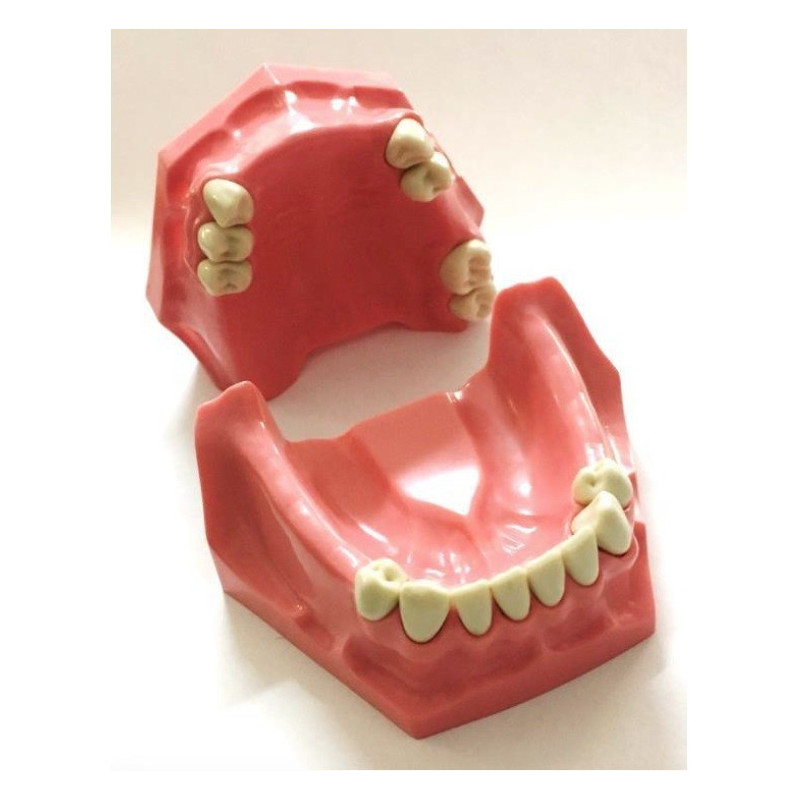 Partial Model for Prosthesis
