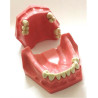 Partial Model for Prosthesis