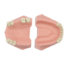 Partial Model for Prosthesis