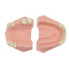 Partial Model for Prosthesis