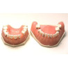 Parodonthology Jaw with diffusely carious teeth
