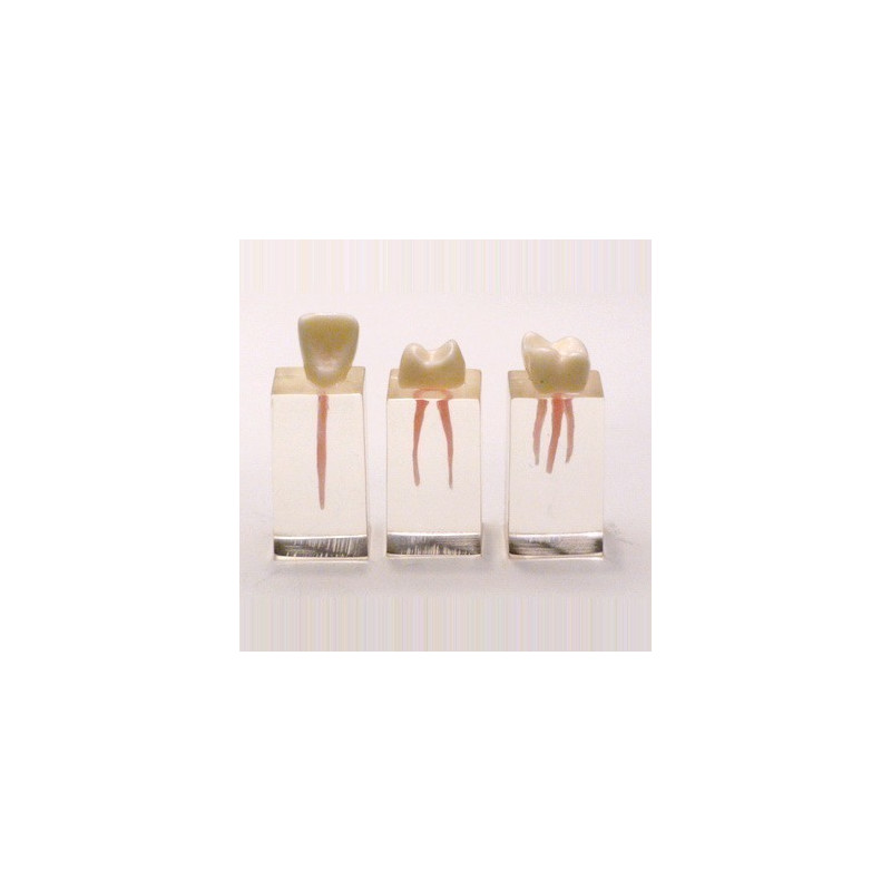 Parallelepiped for endodontic practice