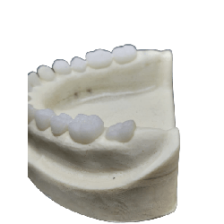Radio-opaque X-Ray Dental Model
