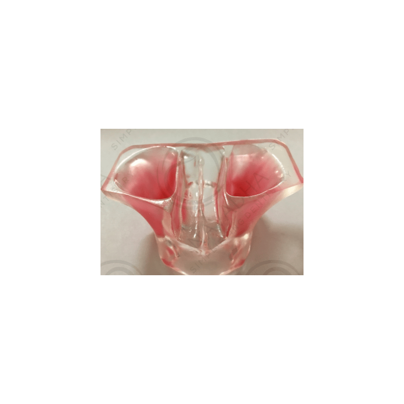 Sinus Lift model - White Resin