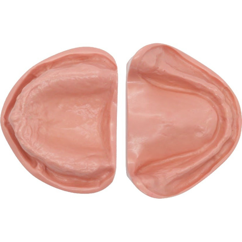 Edentulous Model for Prosthetic Training