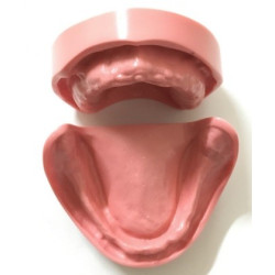 Edentulous Model for Prosthetic Training