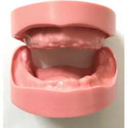 Edentulous Model for Prosthetic Training
