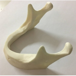 Simple Implant Mandible