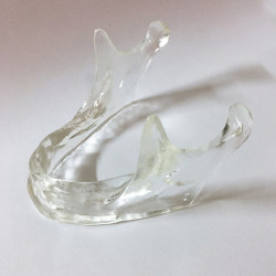 Transparent Implant Mandible