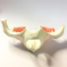 Full-Scale Anatomical Jaw Model with Sinus – Zygomatic Implant Training