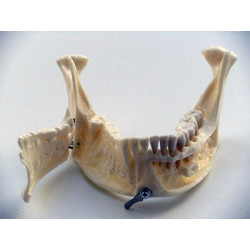 Dental anatomical mandible with extractable teeth
