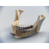 Dental anatomical mandible with extractable teeth