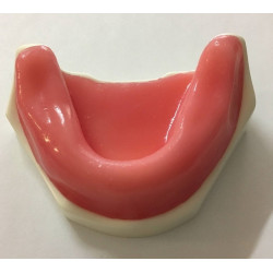Spongy Bone Implant mandible with gums