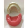 Spongy Bone Implant mandible with gums