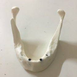 Model of a normal mandible