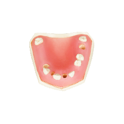 Post Extraction Immediate Implant Model