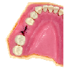 Navadha ZX Typodont Jaw