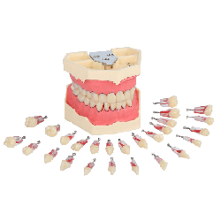 Navadha Endo Typodont Jaw Set & Endodontics Practice Model