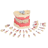 Navadha Endo Typodont Jaw Set & Endodontics Practice Model Extra Teeth Set