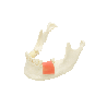 Model for implant placement for replaceable bone blocks of different bone density & Partially edentulous dental model for implan