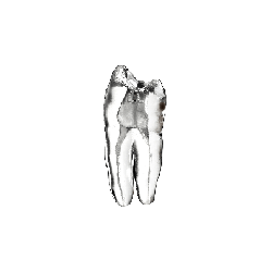 Endo teeth with a clear root canal -11