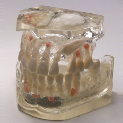 Dental Typodont Jaw / Model for Surgery Practice & Transparent Guide Model