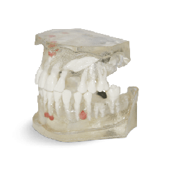 Transparent Guide Model