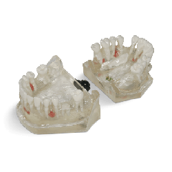Dental Typodont Jaw / Model for Surgery Practice & Model for Surgery