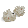 Dental Typodont Jaw / Model for Surgery Practice & Model for Surgery